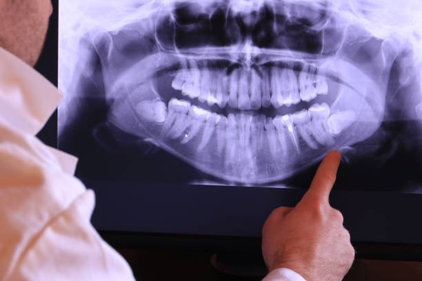 Best Emergency Dental Care for Broken or Chipped Teeth in Medina, WA