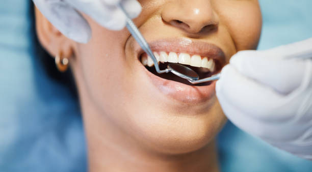 Best Emergency Tooth Extraction in Medina, WA