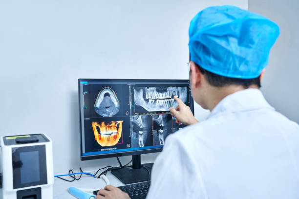Best Emergency Tooth Extraction in Medina, WA